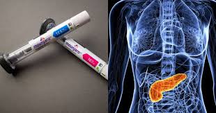 Pancreatite após uso de “canetas emagrecedoras”; saiba quando se preocupar