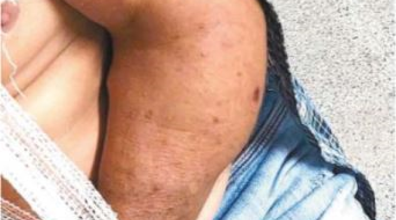 Idoso é agredido com pedra após pedir silêncio