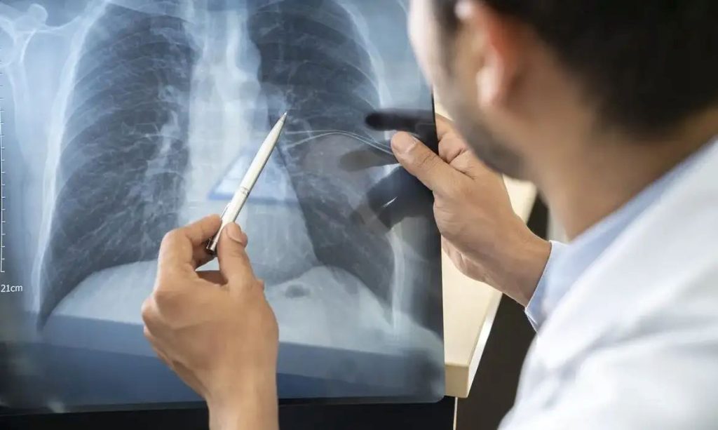 Tabagismo atinge mais jovens de 16 a 24 anos, aponta pesquisa